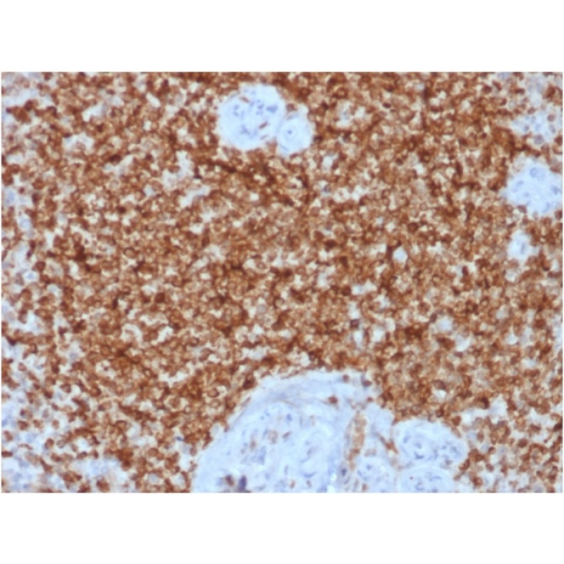 Biotium BNCB1878-100, Bcl-2 (Apoptosis & Follicular Lymphoma Marker) (BCL2/1878R), Biotin conjugate, 0.1mg/mL
