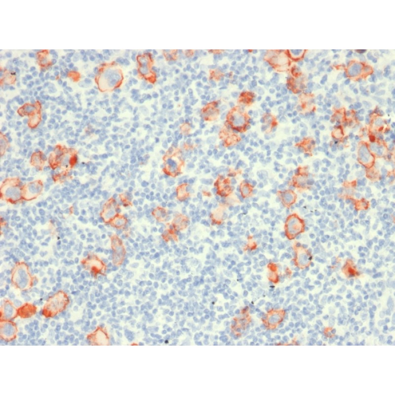 Biotium BNCB1919-500, CD30 / TNFRSF8 (Hodgkin & Reed-Sternberg Cell Marker) (rCD30/412), Biotin conjugate, 0.1mg/mL