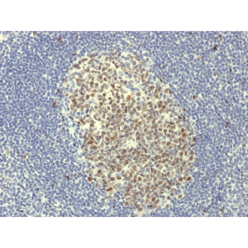 Biotium BNCB1951-100, Bcl-6 (Follicular Lymphoma Marker) (BCL6/1951R), Biotin conjugate, 0.1mg/mL