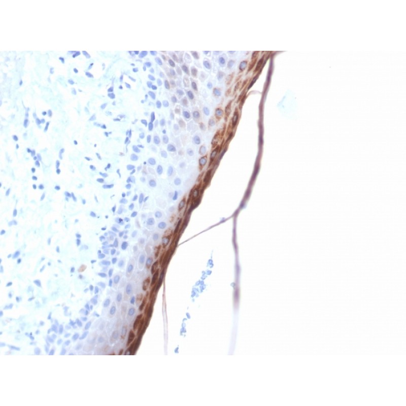 Filaggrin (Keratinocyte Differentiation Marker) (FLG/1957R), Biotin conjugate, 0.1mg/mL