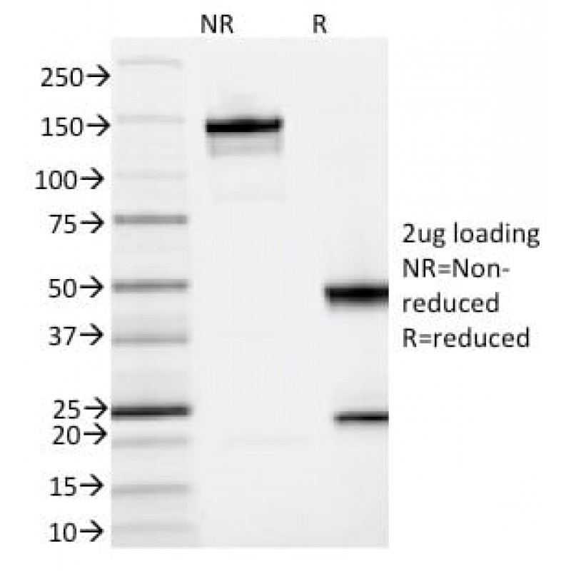 IL3RA / CD123 (Acute Myeloid Leukemia Marker) (IL3RA/2065), Biotin conjugate, 0.1mg/mL