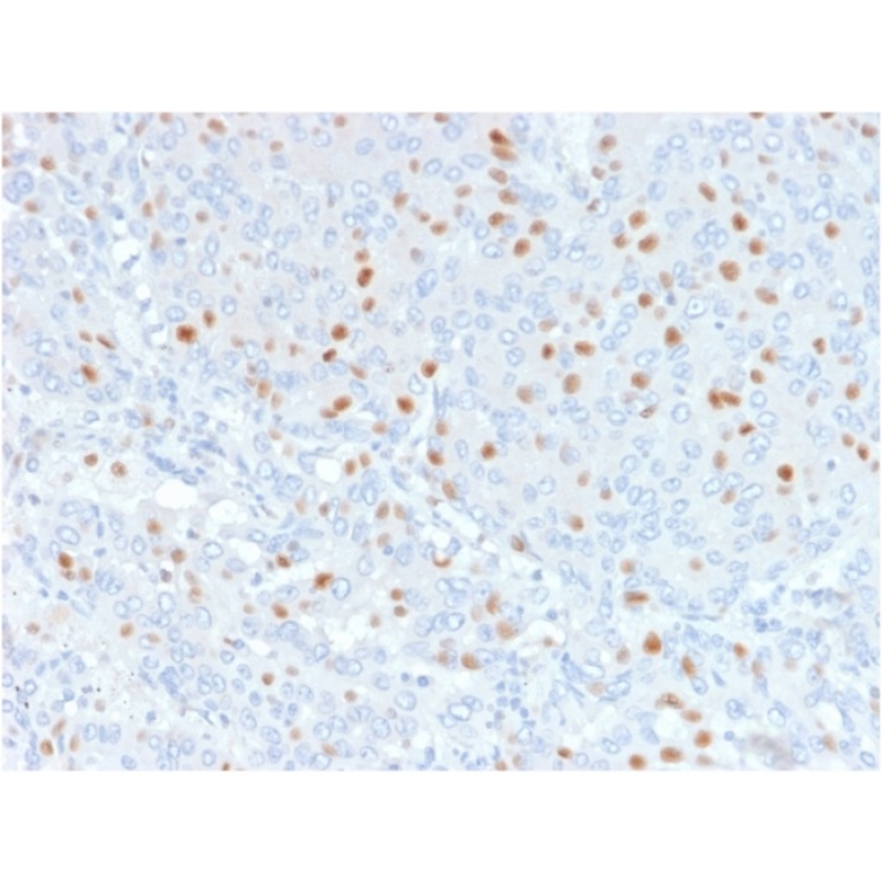 Biotium BNCB2179-100, Annexin A1 / (Hairy Cell Leukemia Marker)(6E4/3), Biotin conjugate, 0.1mg/mL