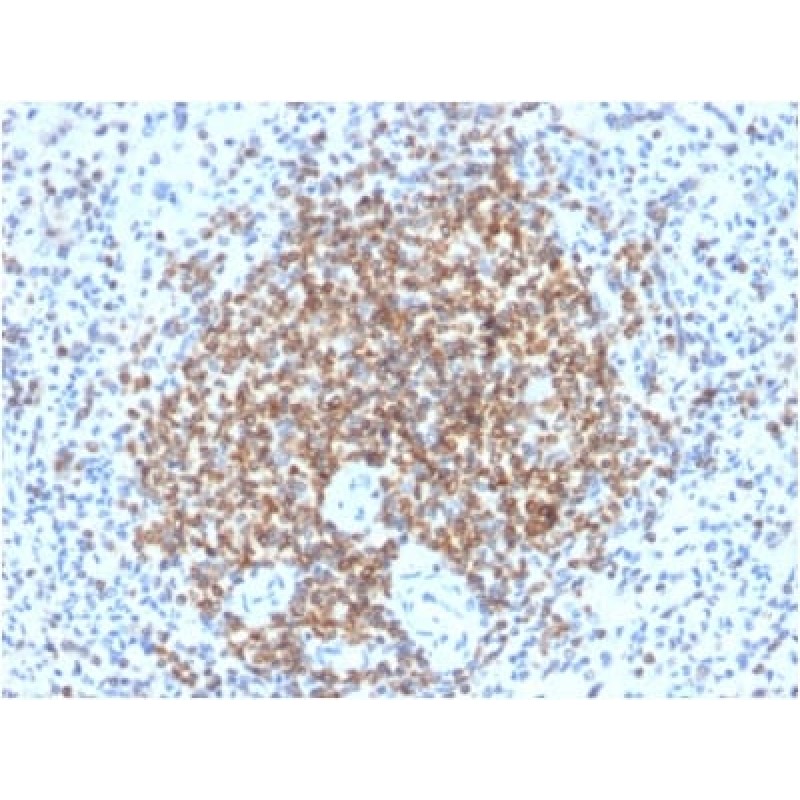 Biotium BNCB2210-100, Bcl-2 (Apoptosis & Follicular Lymphoma Marker) (BCL2/2210R), Biotin conjugate, 0.1mg/mL