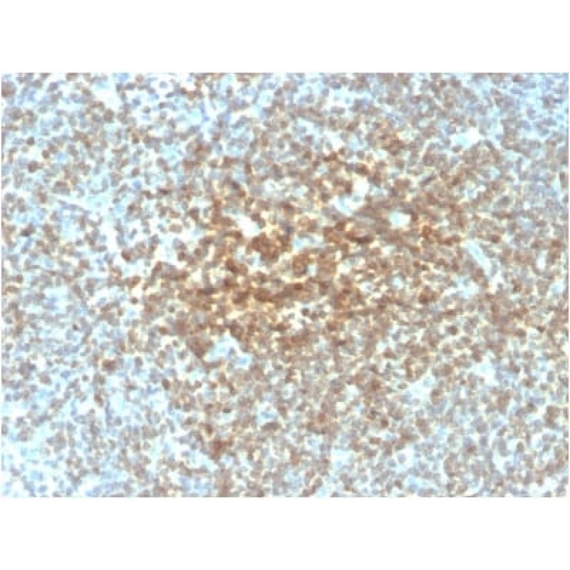 Biotium BNCB2221-100, Bcl-2 (Apoptosis & Follicular Lymphoma Marker) (rBCL2/782), Biotin conjugate, 0.1mg/mL