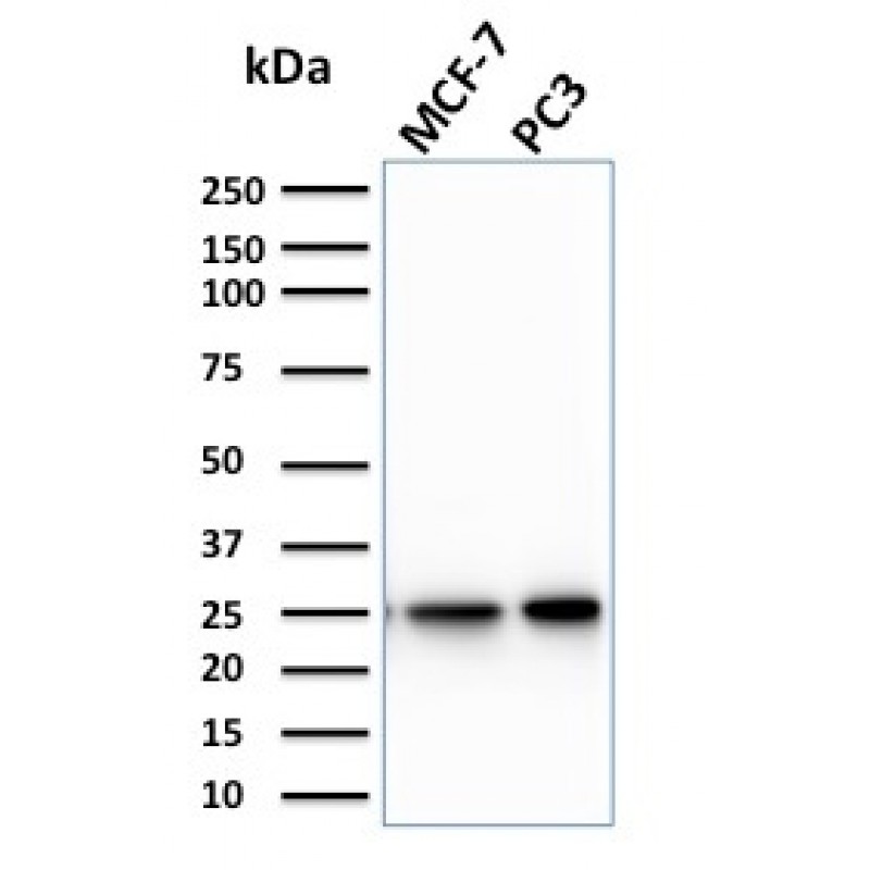 Biotium BNCB2266-100, Calcineurin B homologous protein 2 / HCC Antigen 520(CPTC-CHP2-1), Biotin conjugate, 0.1mg/mL
