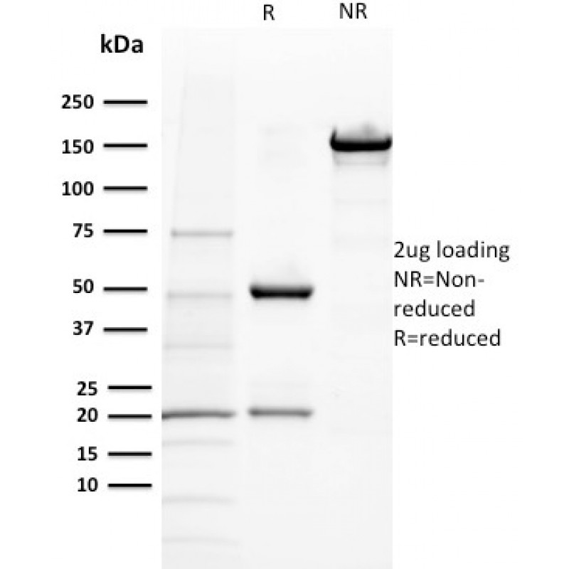 Biotium BNCB2432-100, BAP1 (BRCA1 Associated Protein 1)(BAP1/2432), Biotin conjugate, 0.1mg/mL