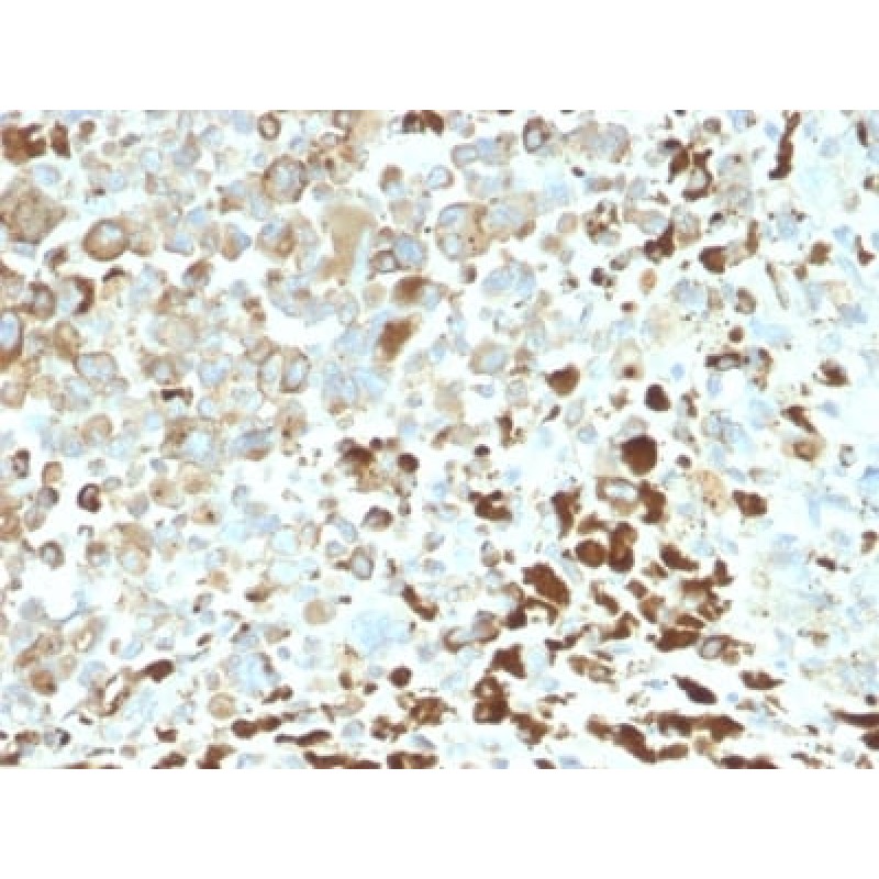 NGF-Receptor (p75) / CD271 (Soft Tissue Tumor Marker) (NGFR/2550R), Biotin conjugate, 0.1mg/mL