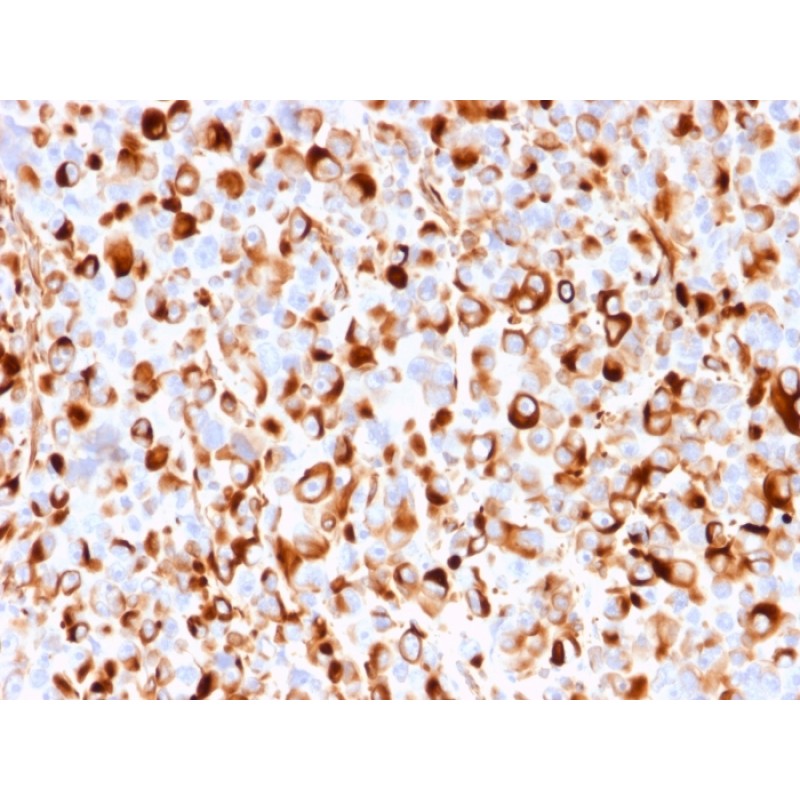 NGF-Receptor (p75) / CD271 (Soft Tissue Tumor Marker)(rNGFR/1965), Biotin conjugate, 0.1mg/mL