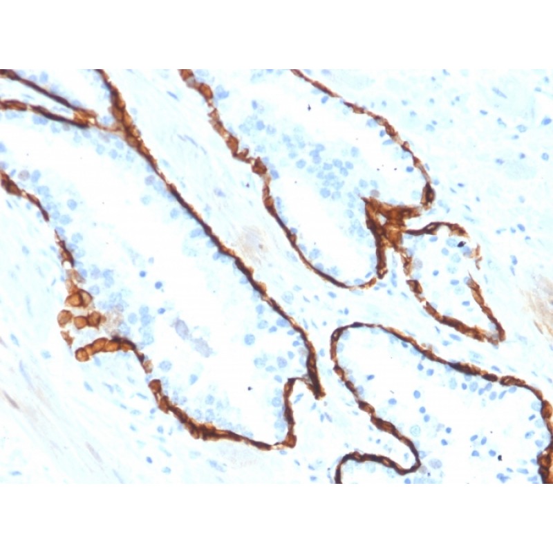 Cytokeratin 15 (Esophageal Squamous Cell Carcinoma Marker)(KRT15/2554), Biotin conjugate, 0.1mg/mL