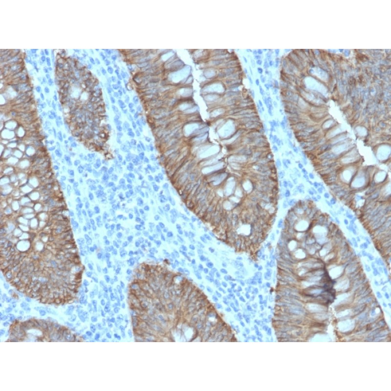 Ep-CAM / CD326 (Extracellular Domain) (Epithelial Marker)(EGP40/2571R), Biotin conjugate, 0.1mg/mL