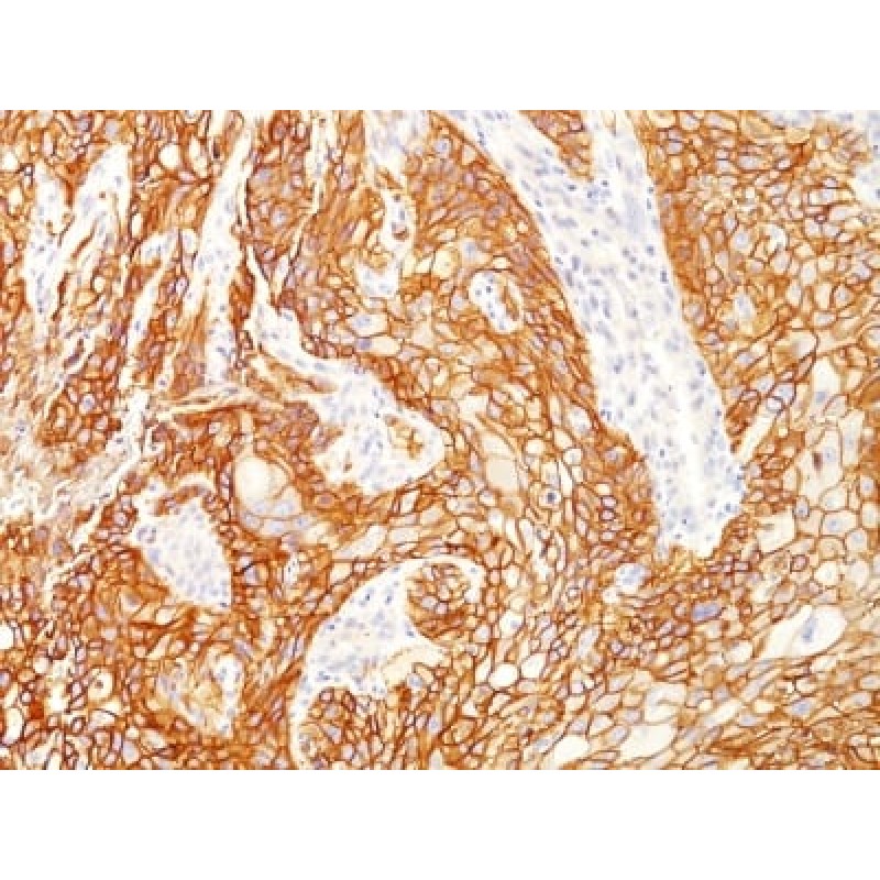 EGFRvIII (Epidermal Growth Factor Receptor, Variant III) (GFR/2600R), Biotin conjugate, 0.1mg/mL