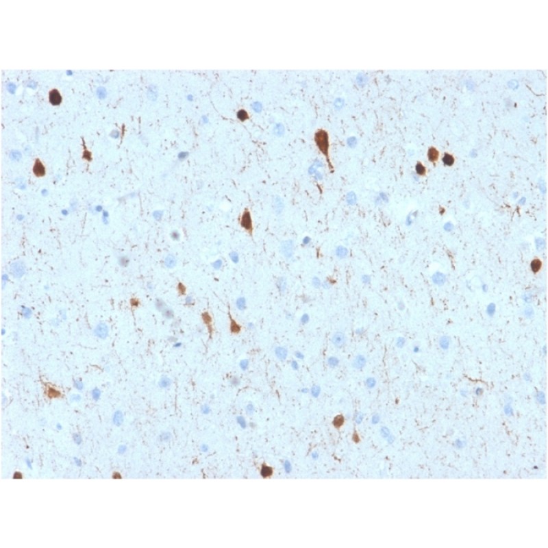 Biotium BNCB2602-100, Calretinin / Calbindin 2 (Mesothelioma Marker)(CALB2/2602), Biotin conjugate, 0.1mg/mL