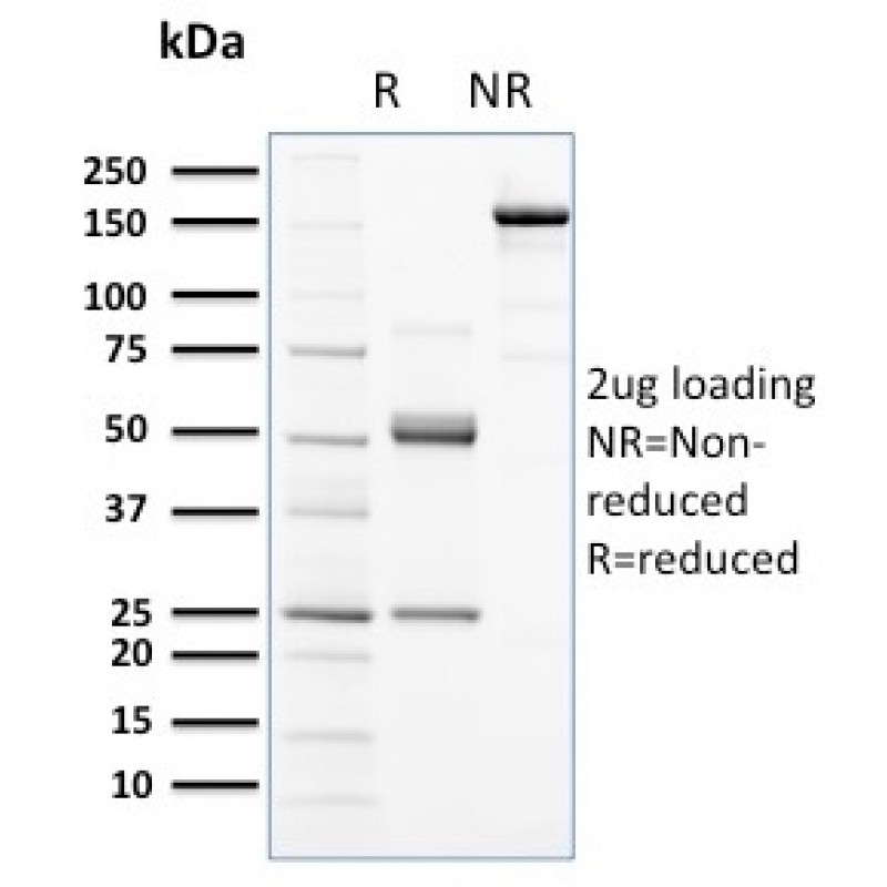 Biotium BNCB2672-100, CD117 / c-Kit (Marker for Gastrointestinal Stromal Tumors)(KIT/2672), Biotin conjugate, 0.1mg/mL