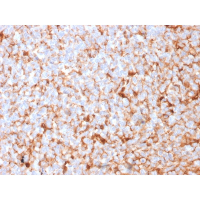 Mammaglobin (SCGB2A2) (Breast Cancer Marker)(MGB1/2682R), Biotin conjugate, 0.1mg/mL