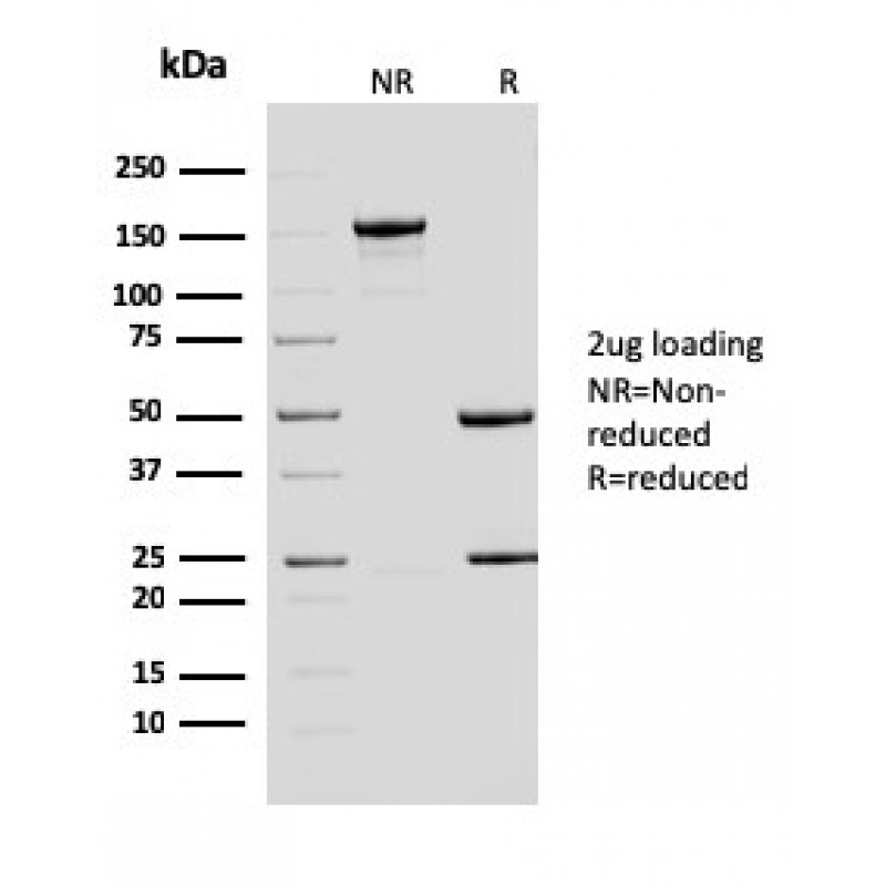 ERCC1 / RAD10 (Tumor Progression Marker)(ERCC1/2683), Biotin conjugate, 0.1mg/mL