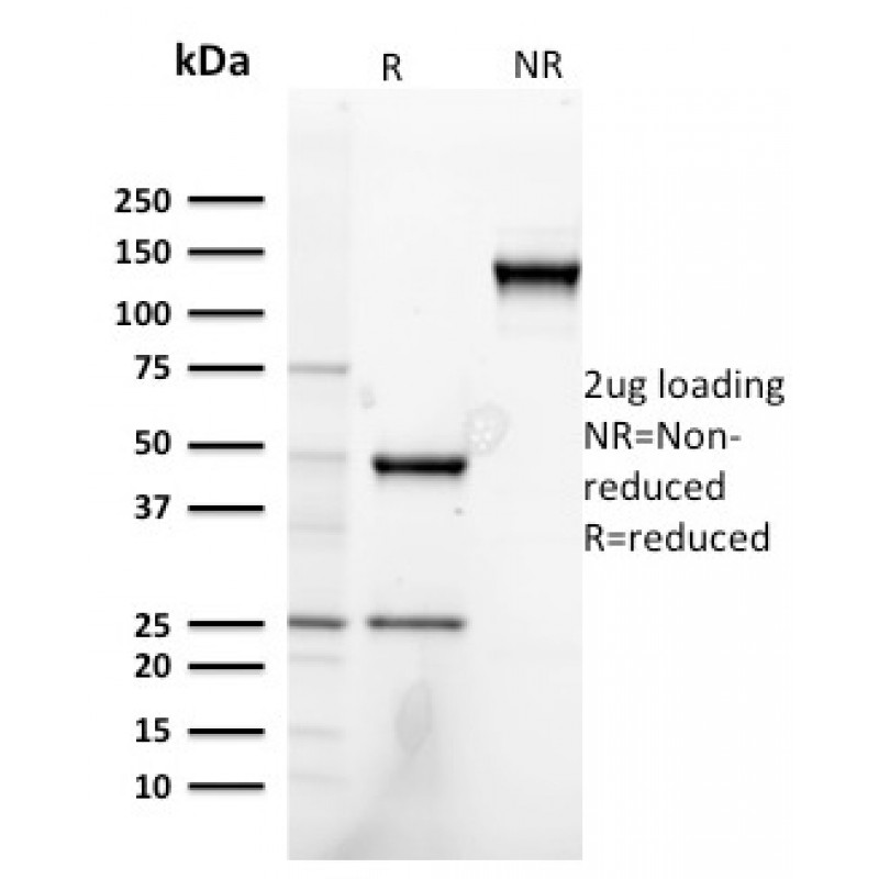 Heregulin-1 / Neuregulin-1 (Breast and Urothelial Marker)(NRG1/2752), Biotin conjugate, 0.1mg/mL