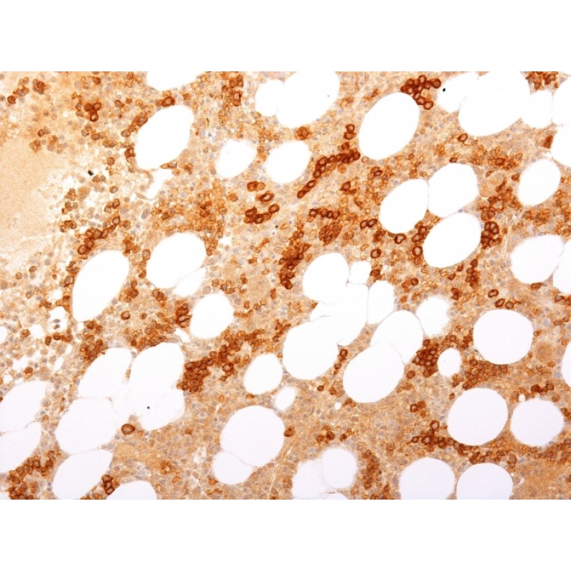 CD71 / Transferrin Receptor (TFRC) (Extracellular Domain)(TFRC/2898R), Biotin conjugate, 0.1mg/mL