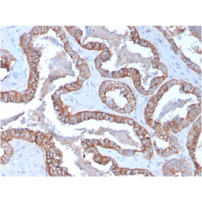Cytokeratin 15 (Esophageal Squamous Cell Carcinoma Marker)(KRT15/2957), Biotin conjugate, 0.1mg/mL