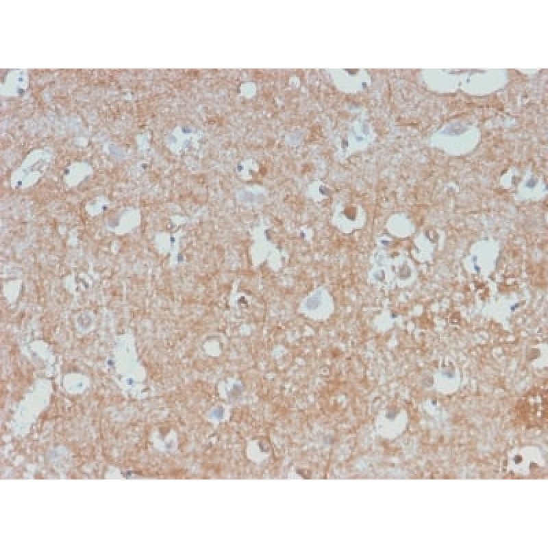 Neurofilament (NF-L) (Neuronal Marker) (NEFL/2983R), Biotin conjugate, 0.1mg/mL