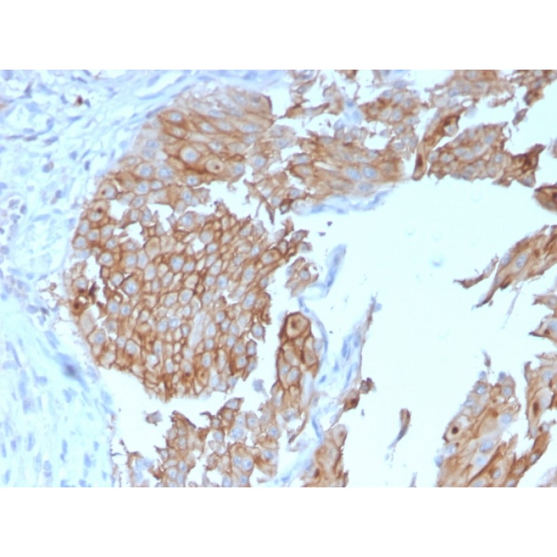 Uroplakin 1B (Urothelial Differentiation Marker)(UPK1B/3102), Biotin conjugate, 0.1mg/mL