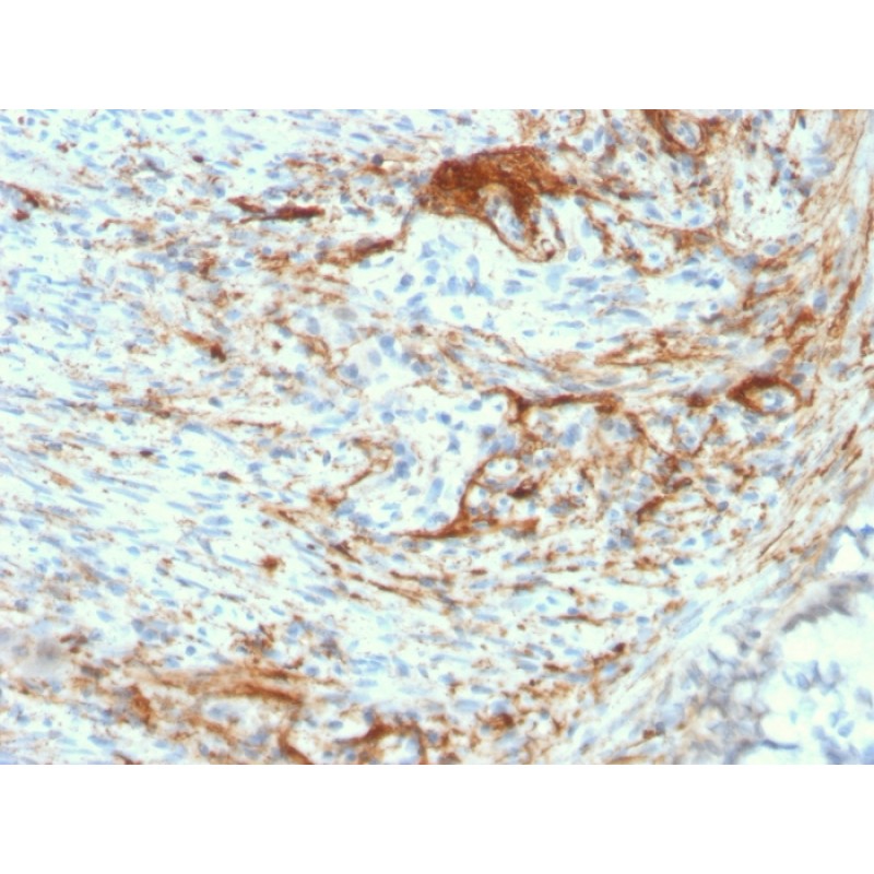 Elastin (ELN) (Marker of Arterial Stiffness and Atherosclerosis)(ELN/3131R), Biotin conjugate, 0.1mg/mL