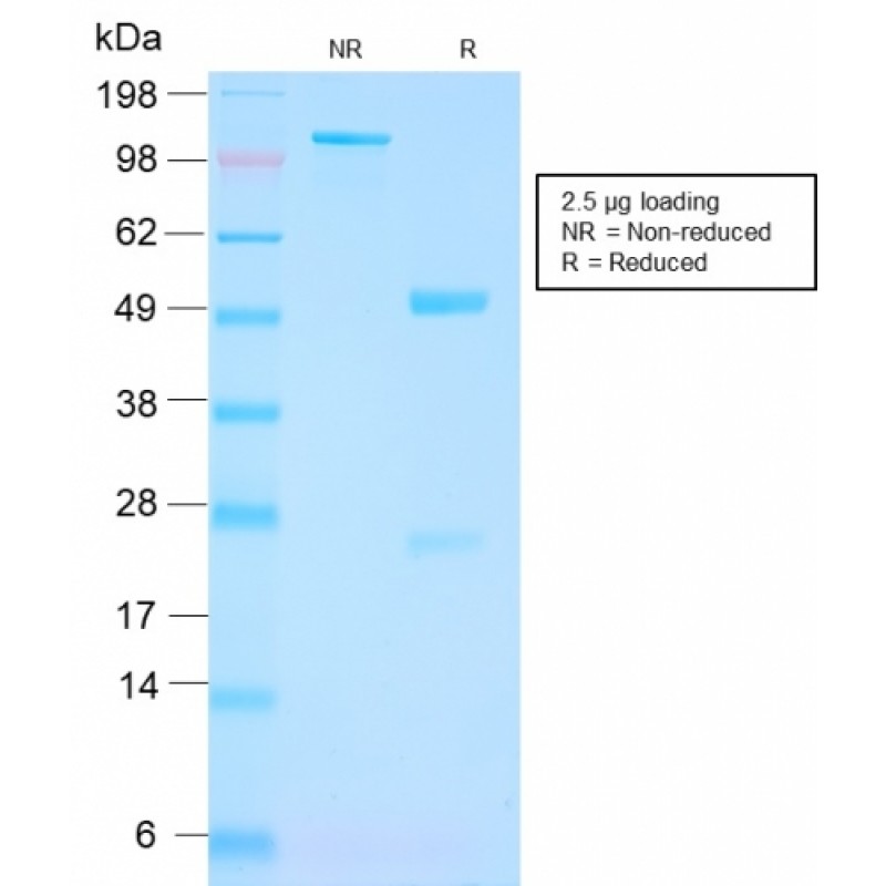 FOLH1 / PSMA (Prostate Epithelial Marker)(FOLH1/3149R), Biotin conjugate, 0.1mg/mL