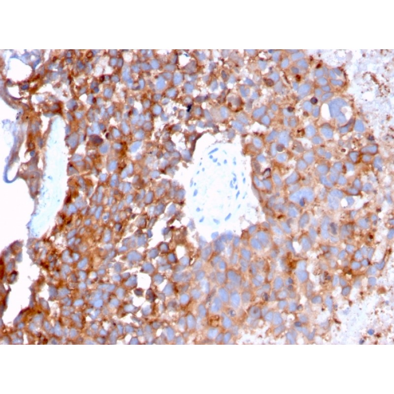 Uroplakin 1B (Urothelial Differentiation Marker)(UPK1B/3273), Biotin conjugate, 0.1mg/mL
