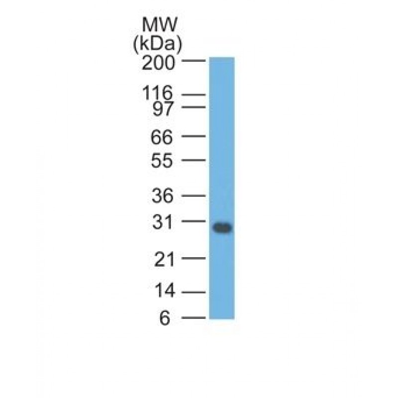 bcl-x(BX006), 0.2mg/mL