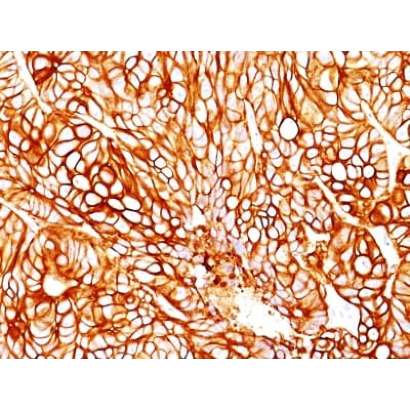 Cytokeratin 18 (KRT18) (DA7), 1mg/mL