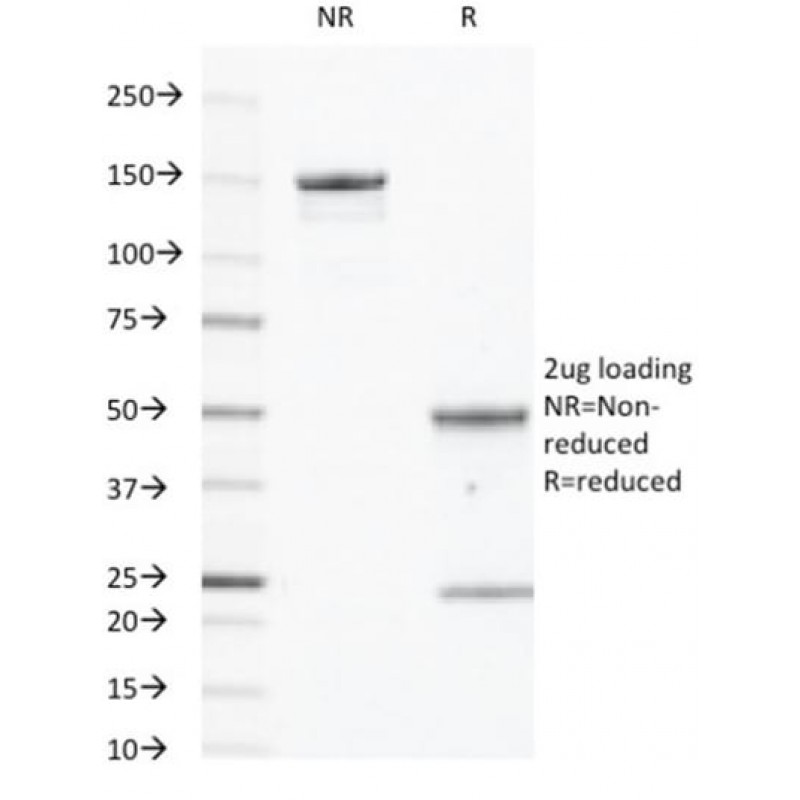 EGFR(GFR450), 0.2mg/mL