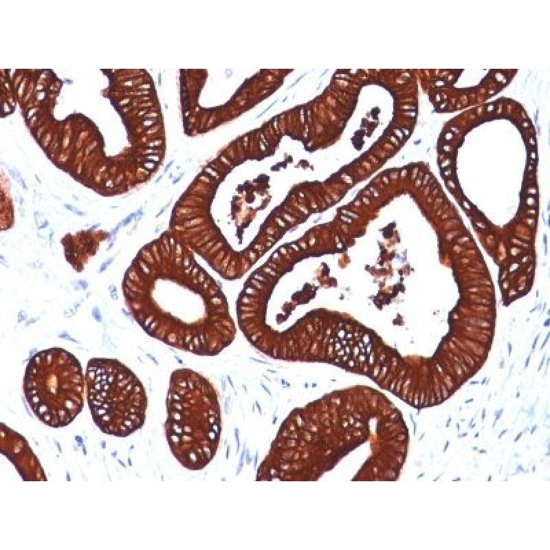 Cytokeratin 19(BA17), 0.2mg/mL