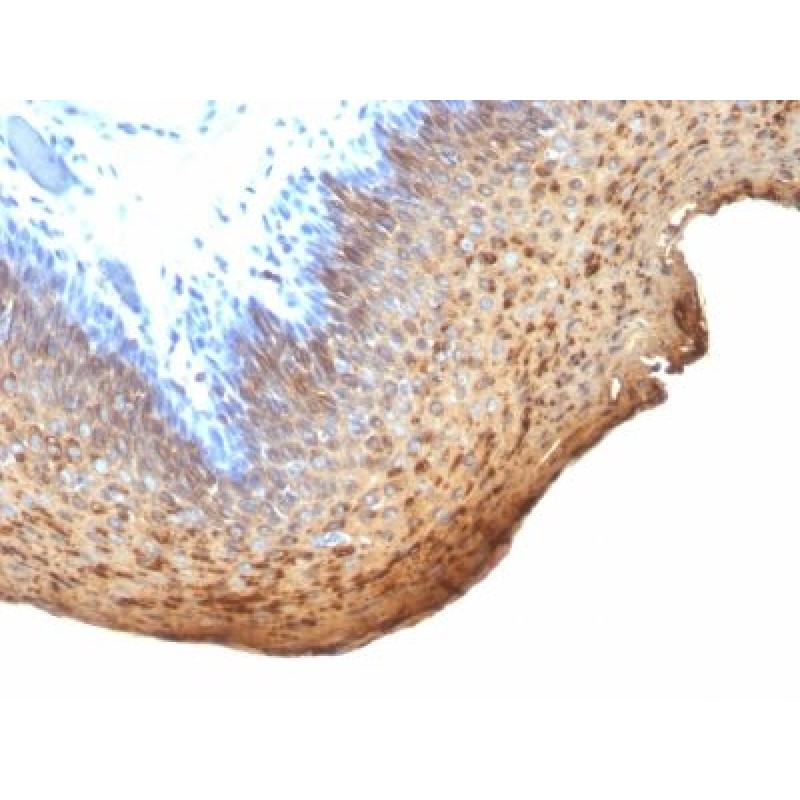 Cytokeratin 10/13(DE-K13), 0.2mg/mL