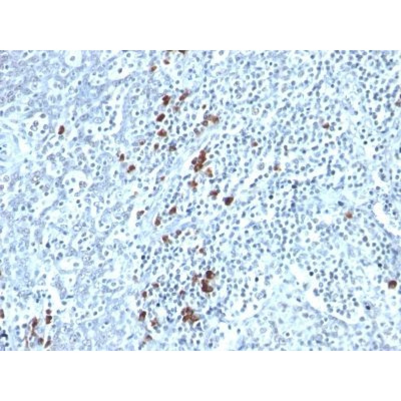 Kappa Light Chain(TB28-2), 0.2mg/mL