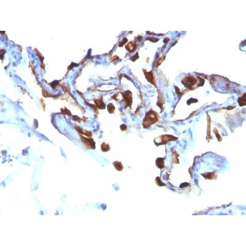 Cytokeratin 8(KRT8/803), 0.2mg/mL