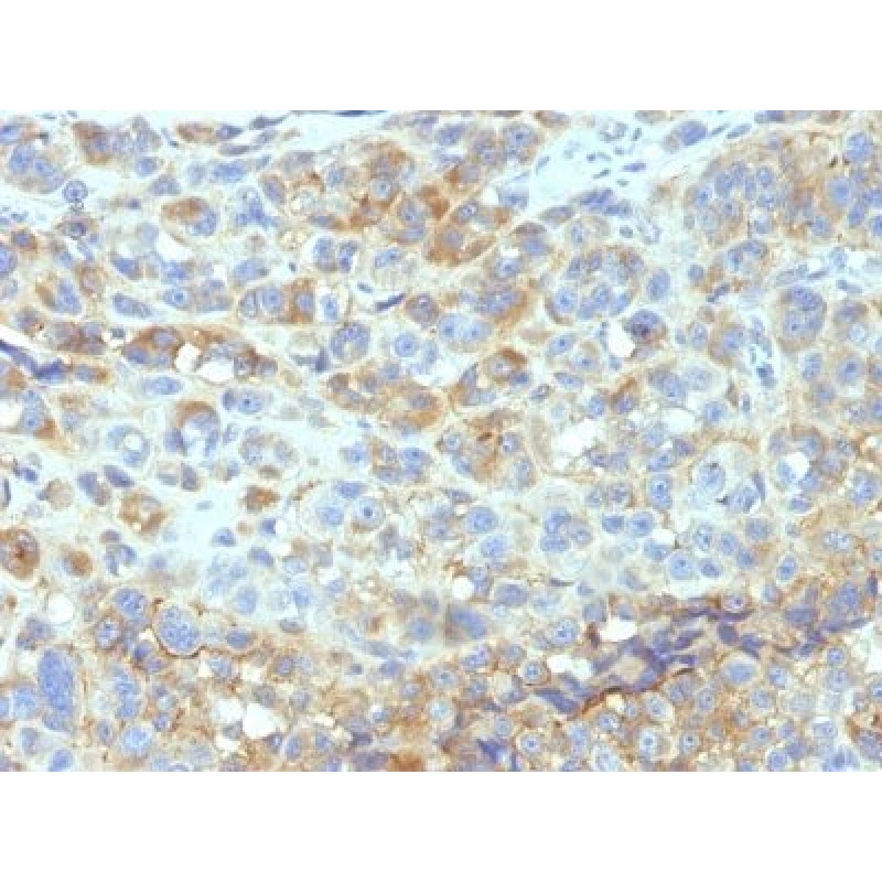 CD54(W-CAM-1; same as Wehi-CAM-1 or 1H4), 0.2mg/mL