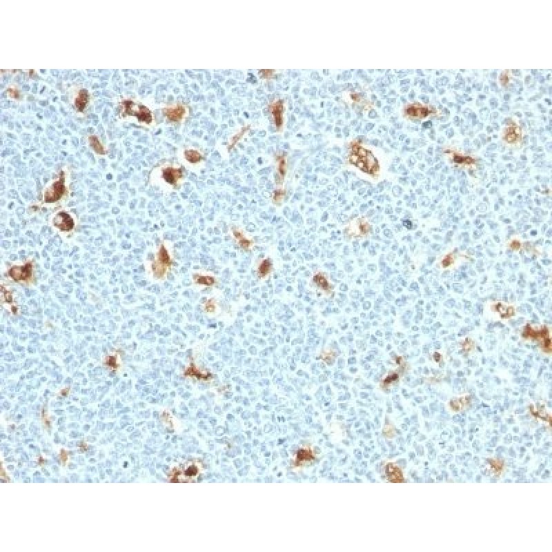 S100A9(S100A9/1011), 0.2mg/mL