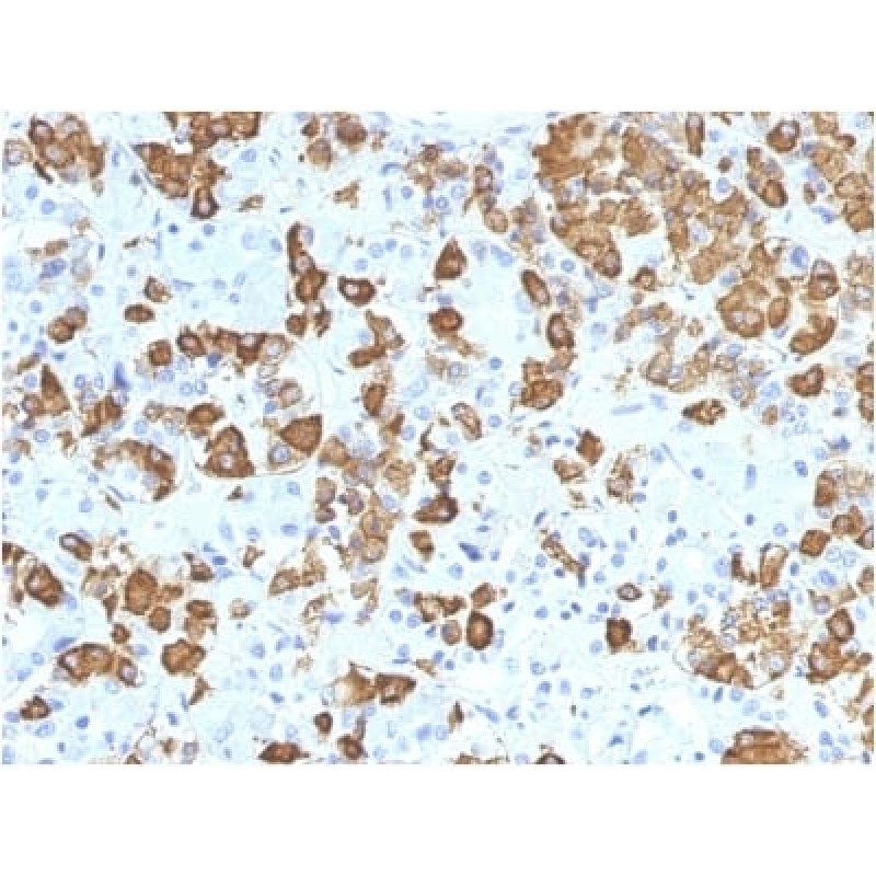 Growth Hormone (Pituitary Marker) (GH/1371), 0.2mg/mL