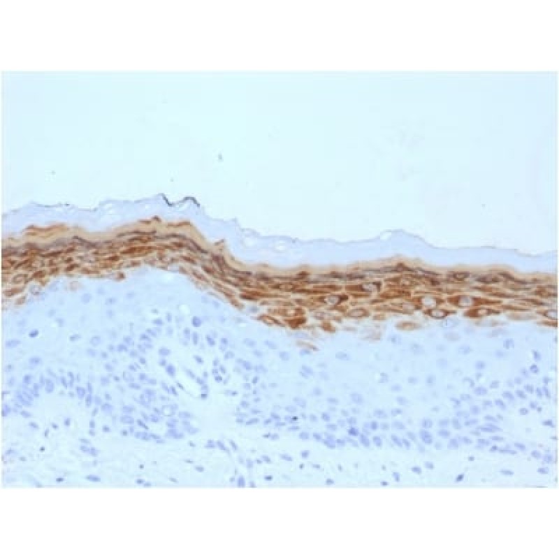 Filaggrin (Keratinocyte Differentiation Marker) (FLG/1561), 0.2mg/mL