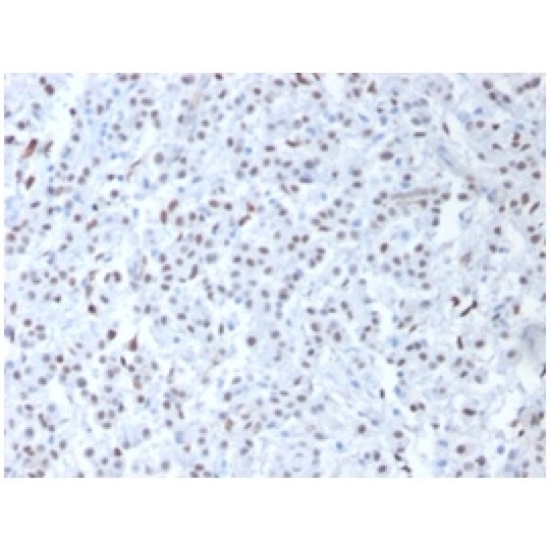 Wilm's Tumor 1 (WT1) (Wilm's Tumor & Mesothelial Marker), 0.2mg/mL