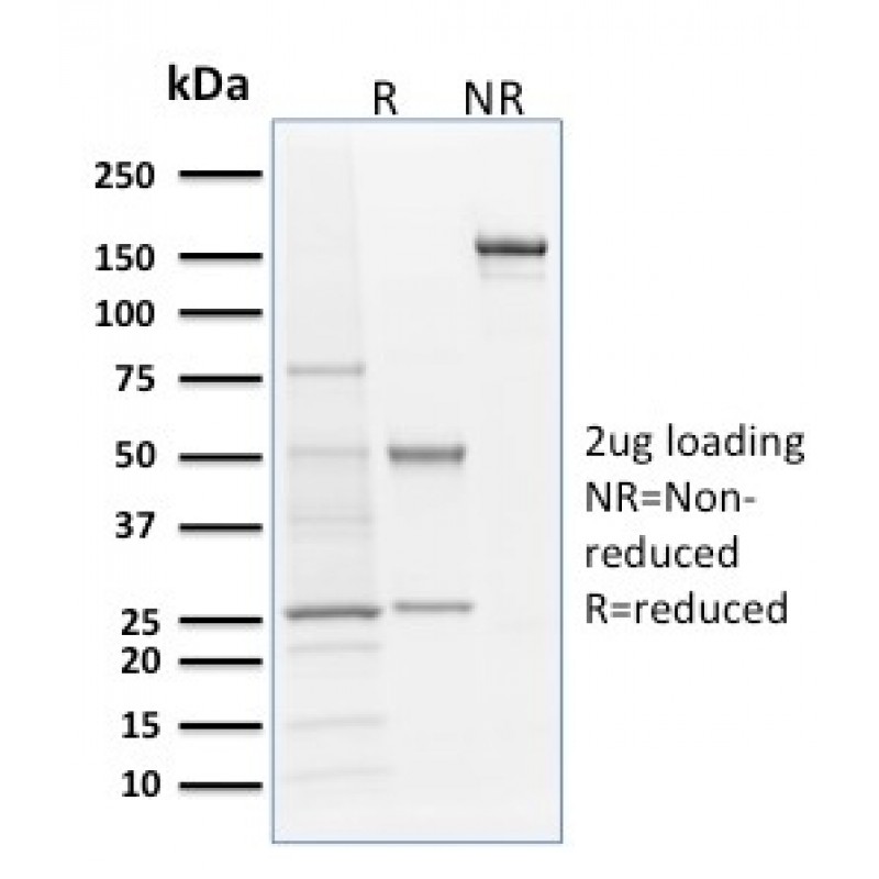 Langerin / CD207 (Marker of Langerhans Cells)(LGRN/1821), 0.2mg/mL