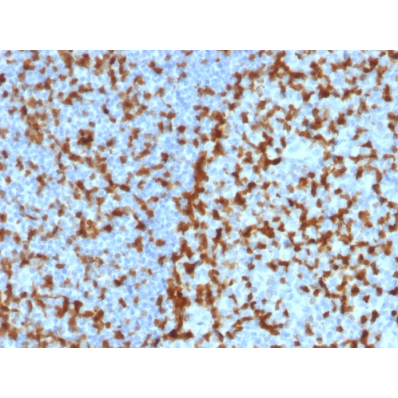 ZAP70 (Chronic Lymphocytic Leukemia Marker)(ZAP70/2047), 0.2mg/mL