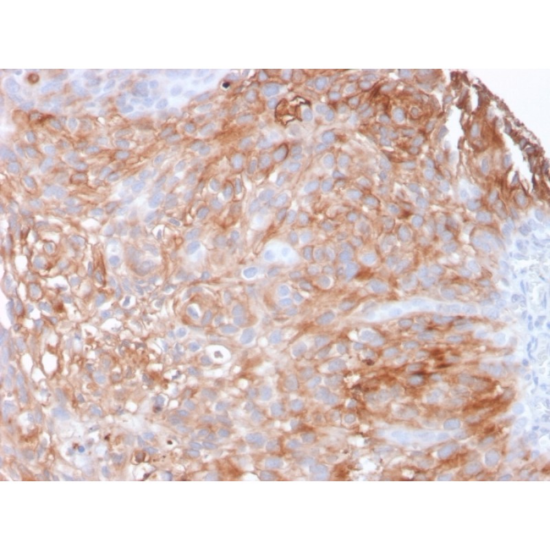 Uroplakin 1A (Urothelial Differentiation Marker)(UPK1A/2925), 0.2mg/mL