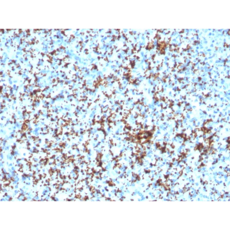 CD61 / Integrin 3 / Platelet Glycoprotein IIIa (Platelet Marker)(ITGB3/3126R), 0.2mg/mL