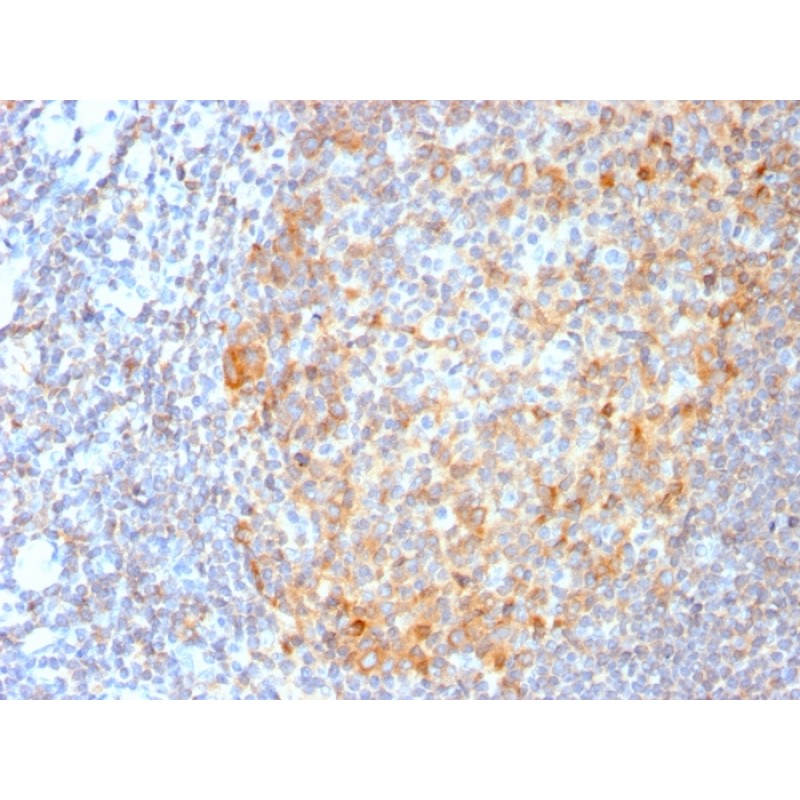 MALT1 (MALT-Lymphoma Marker)(MT1/3159R), 0.2mg/mL
