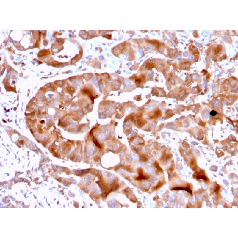 FABP5 (Marker of Metastatic Potential in Colorectal Cancer)(FABP5/3750), 0.2mg/mL