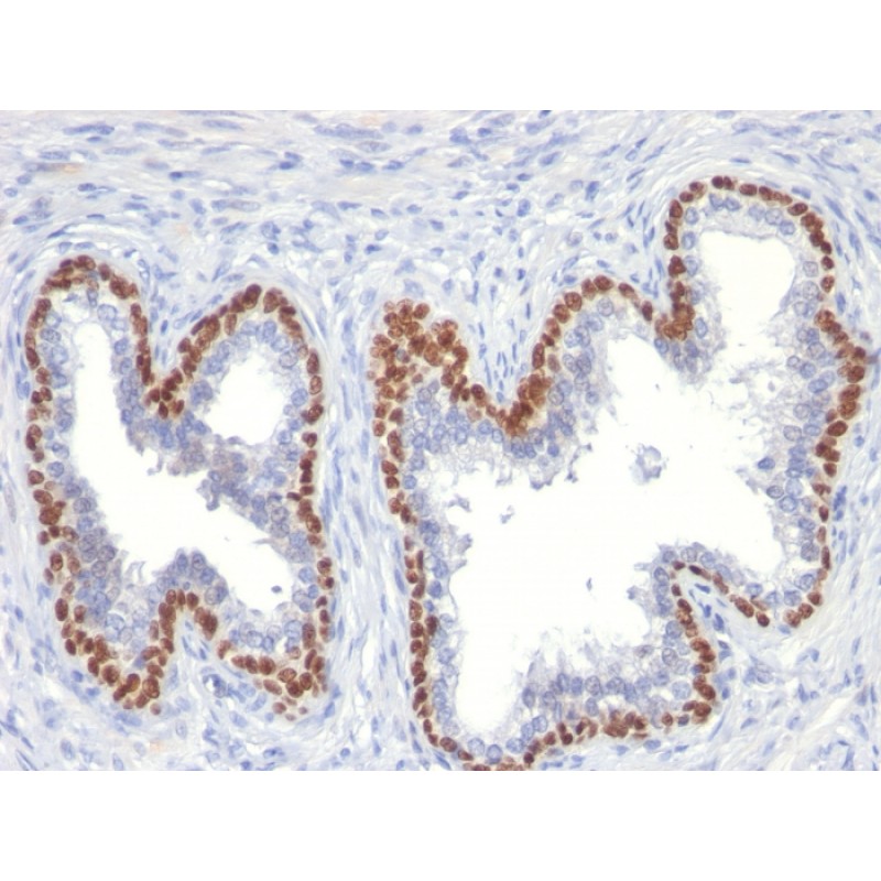 p63 (Squamous, Basal & Myoepithelial Cell Marker)(TP63/11), 1mg/mL