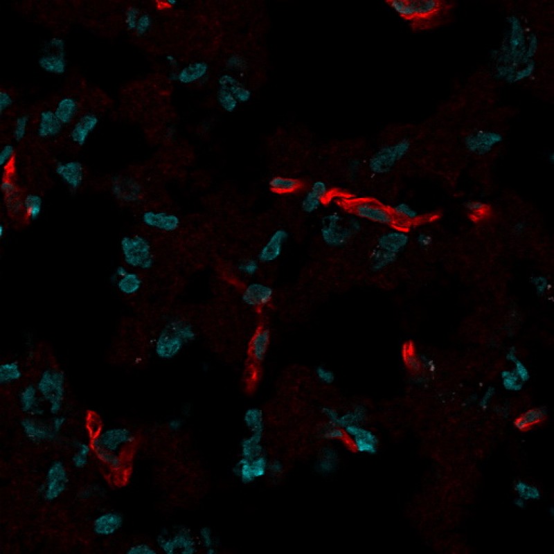 CD31 / PECAM-1(C31.7), 1mg/mL