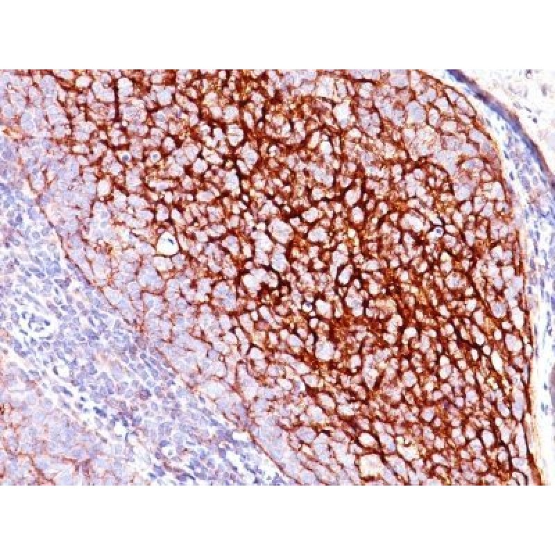 CD35 / CR1(E11), 1mg/mL