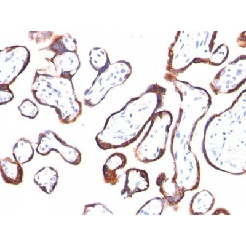 HCG-beta(HCGb/54), 1mg/mL