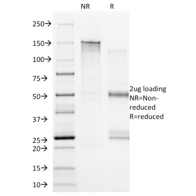 CD20(B9E9), 1mg/mL